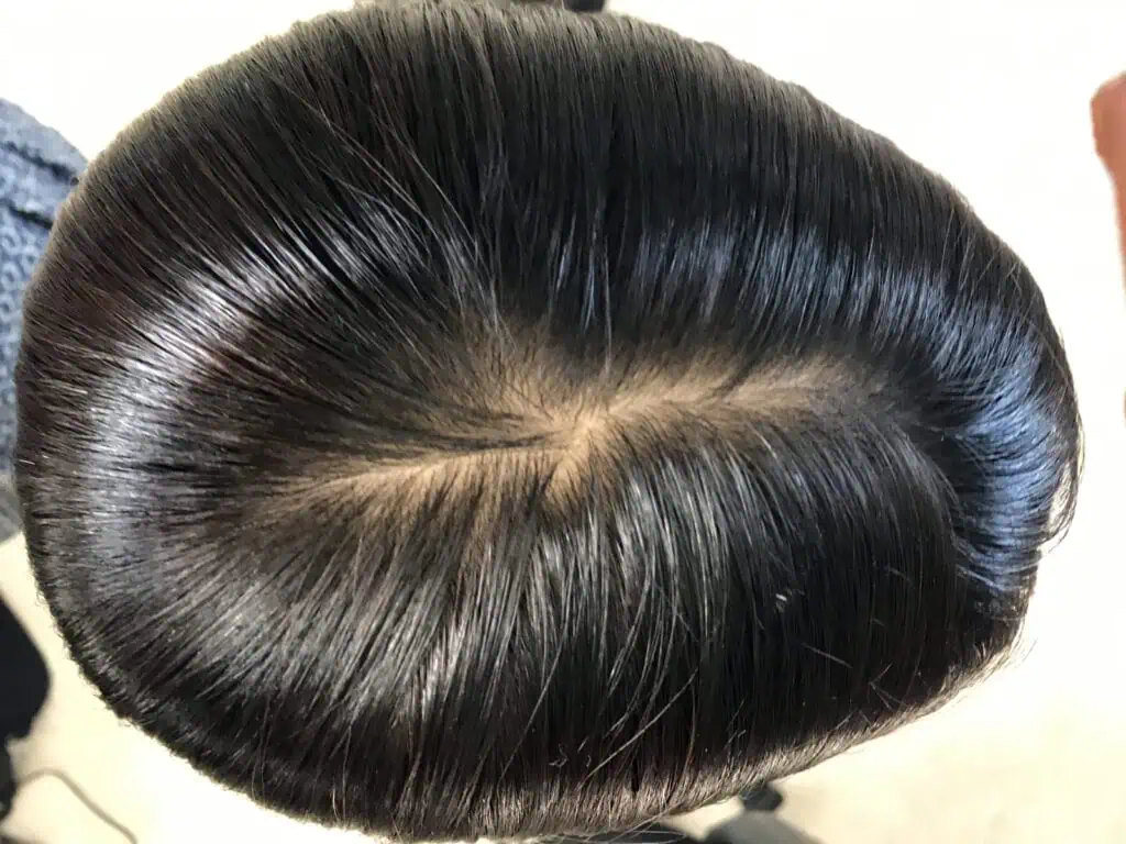 Top view of a custom human hair wig with a natural-looking crown and part